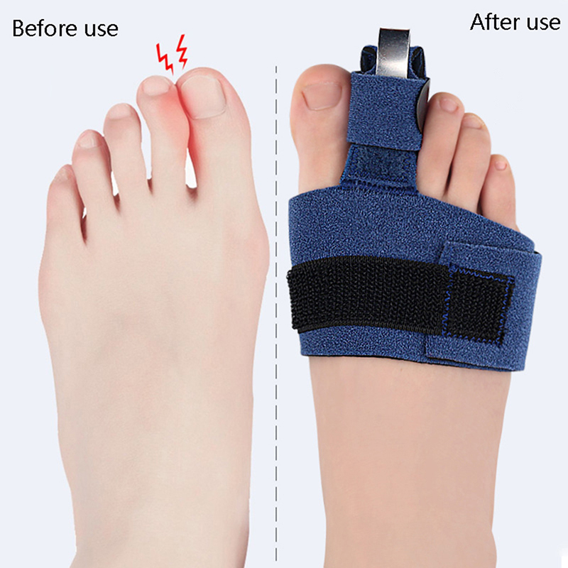 1Pcs Toe Corrector Toe Fractur - đánh giá và giá Ankle Brace Sock