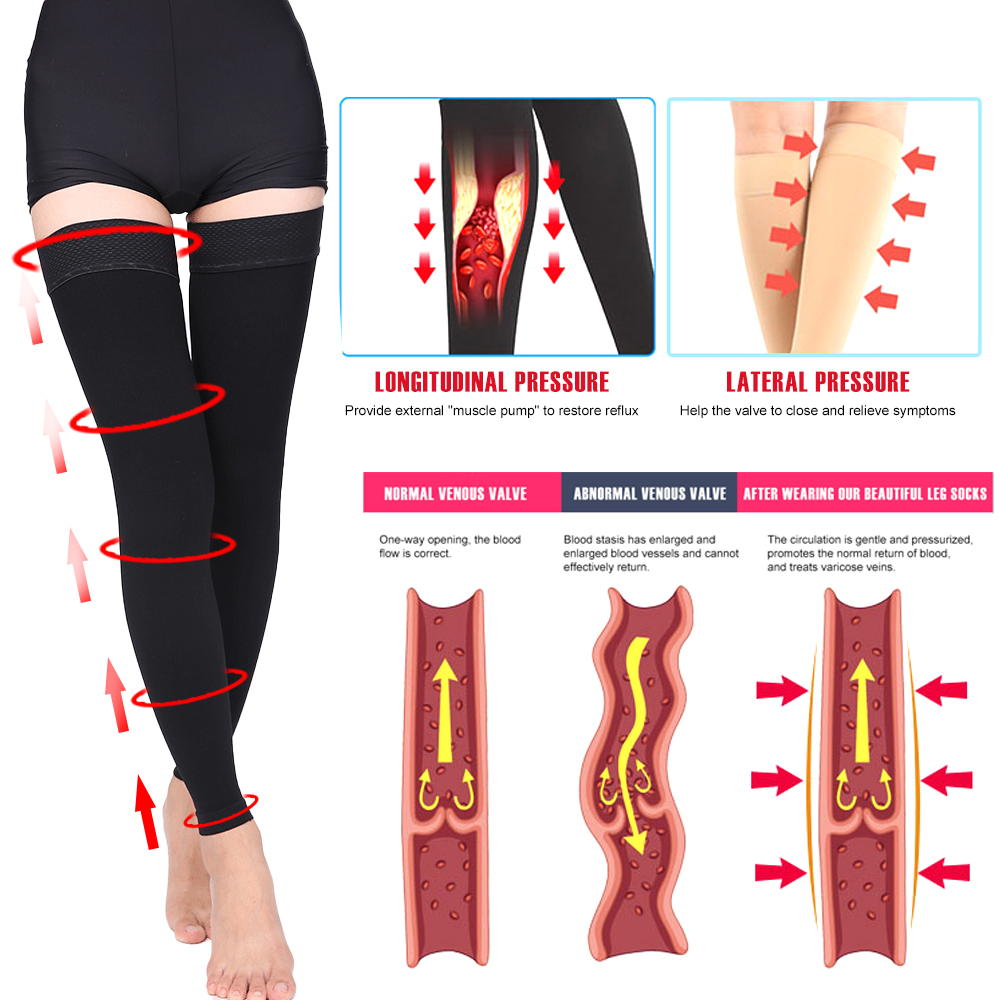 Open Toe Knee-High Medical Com - đánh giá và giá Compression Sock Medical